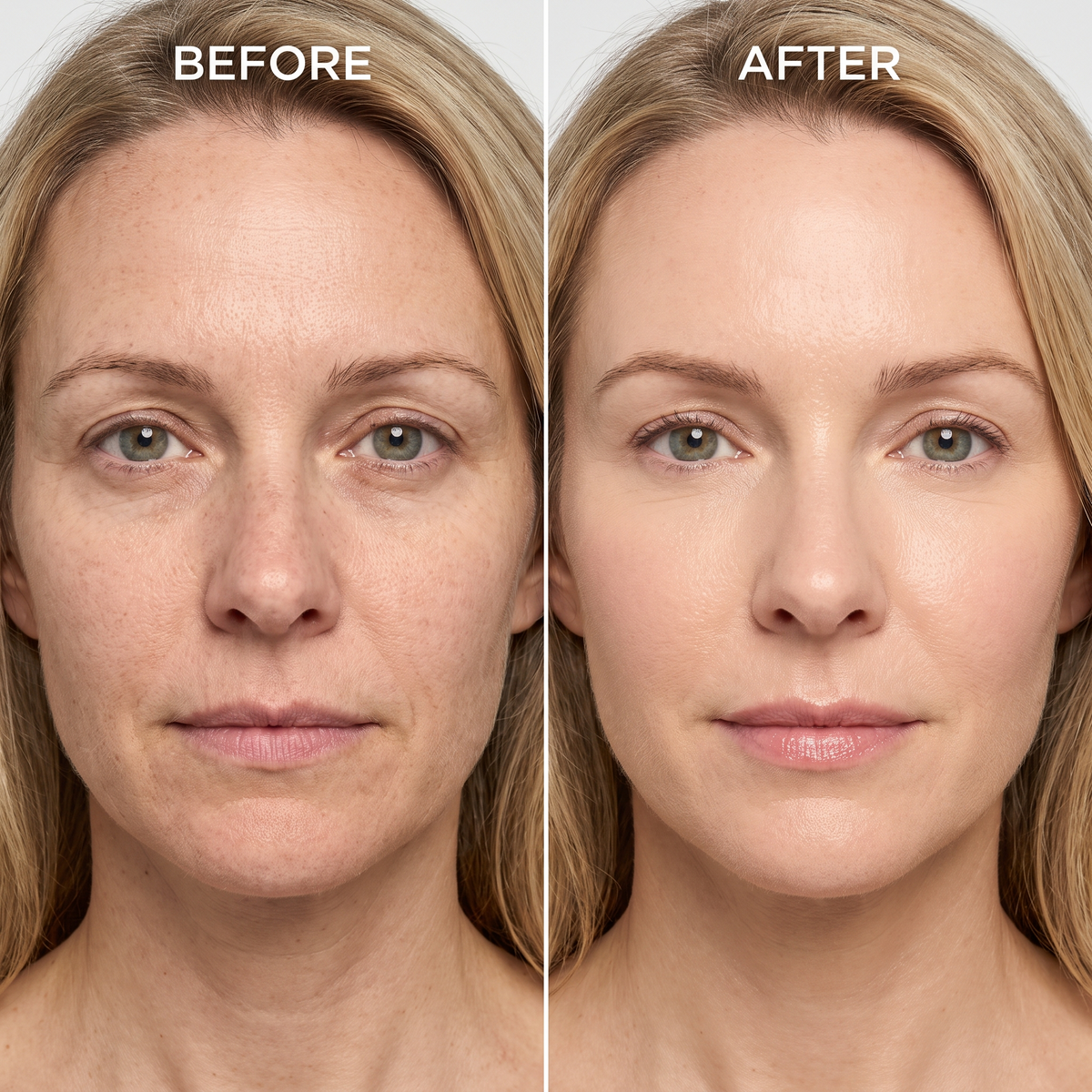 Under-Eye Plumping Balm